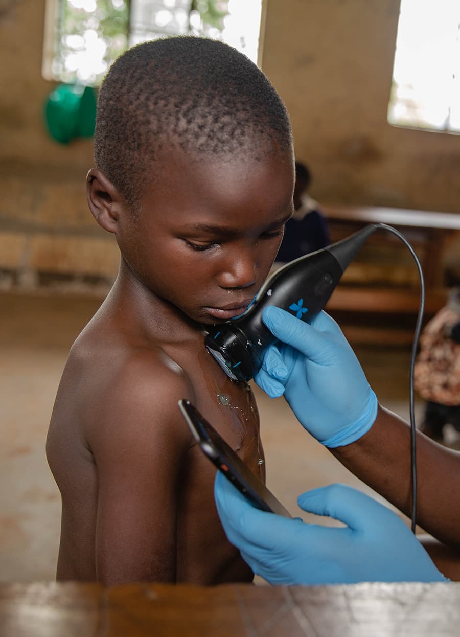 A child getting scanned with Butterfly iQ